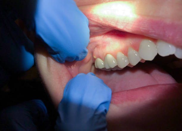 Best Emergency Treatment for Jaw Pain or Injury in Douglas, GA